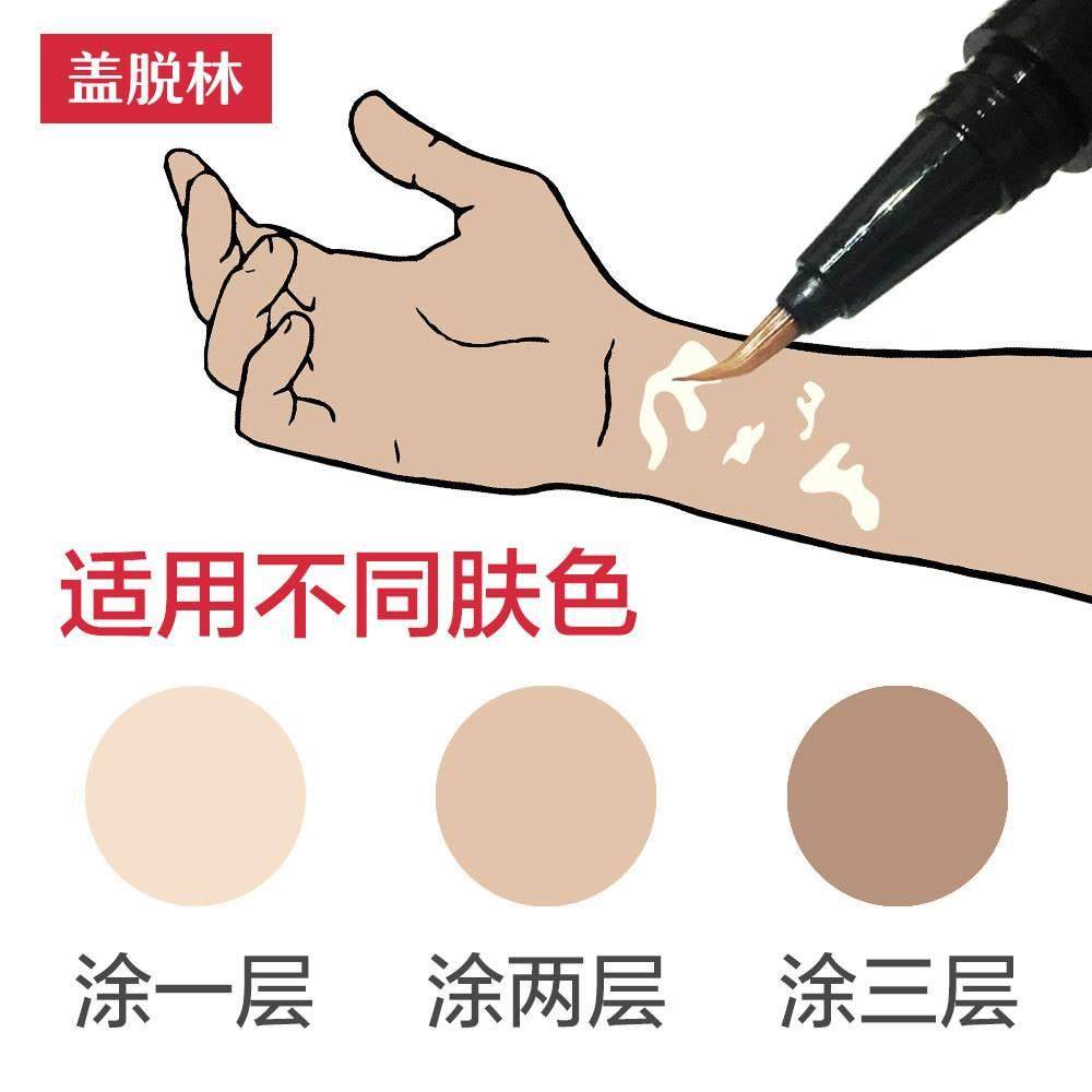 极速白癜風遮盖液脖子肘部手上防水汗外用白斑一R抹净遮盖笔肤色,彩妆/香水/美妆工具,遮瑕,淘宝优惠券,粉丝福利购,淘宝优惠卷
