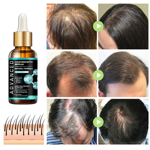 极速Fast Hagir Growth Essential Oil Anti Hair Loss Treatment
