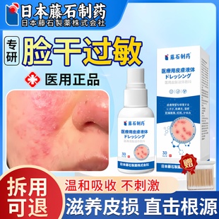 过敏皮肤修复医用脸部过敏痒红肿修复干燥起皮脂溢性皮炎ZR