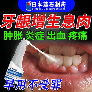 牙龈增生息肉专用喷剂治疗牙龈脓包肿痛膏消炎牙根发炎药房同售ZR