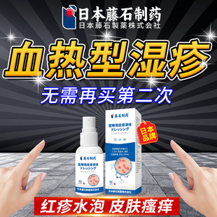 日本品牌血热型湿疹瘙痒真菌感染可搭药膏止痒去外用顽固皮炎根BD