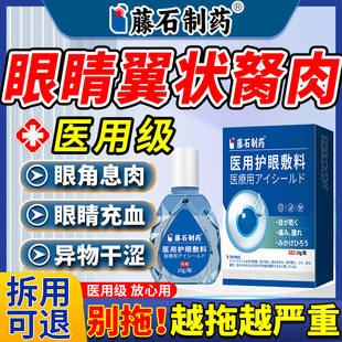 去眼睛胬肉专用眼角翼状胬肉息肉可搭滴眼液眼模糊看不清明目JV