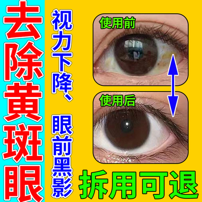 【医用级】眼底黄斑专用滴眼液