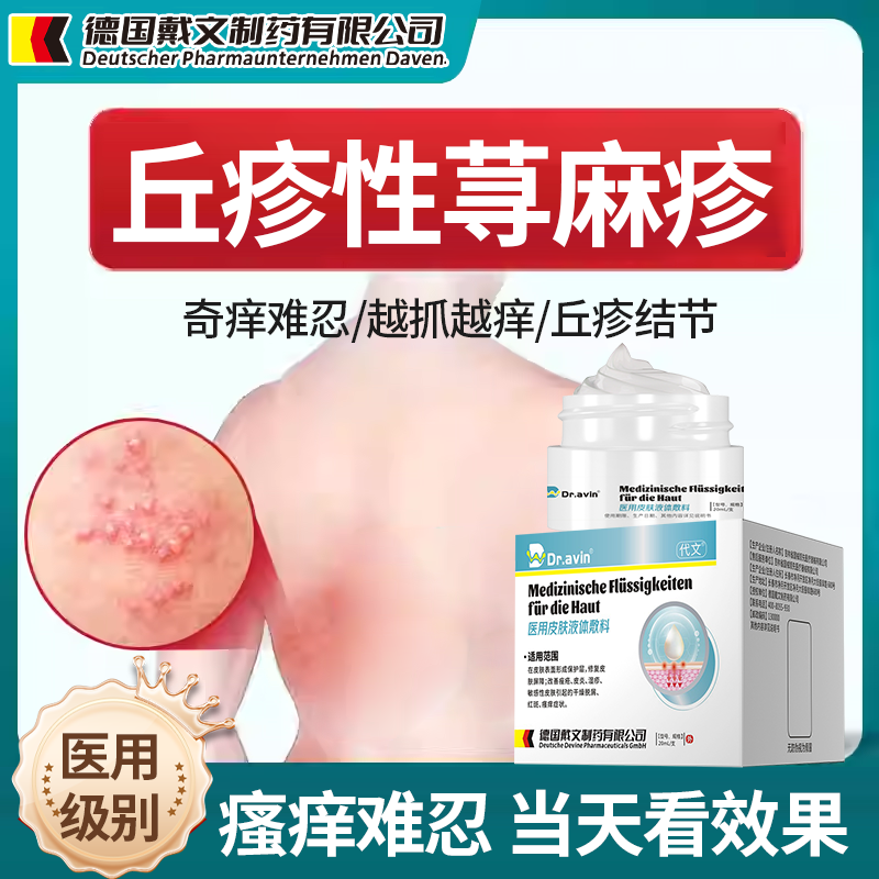 【拆用可退】丘疹性荨麻疹专用