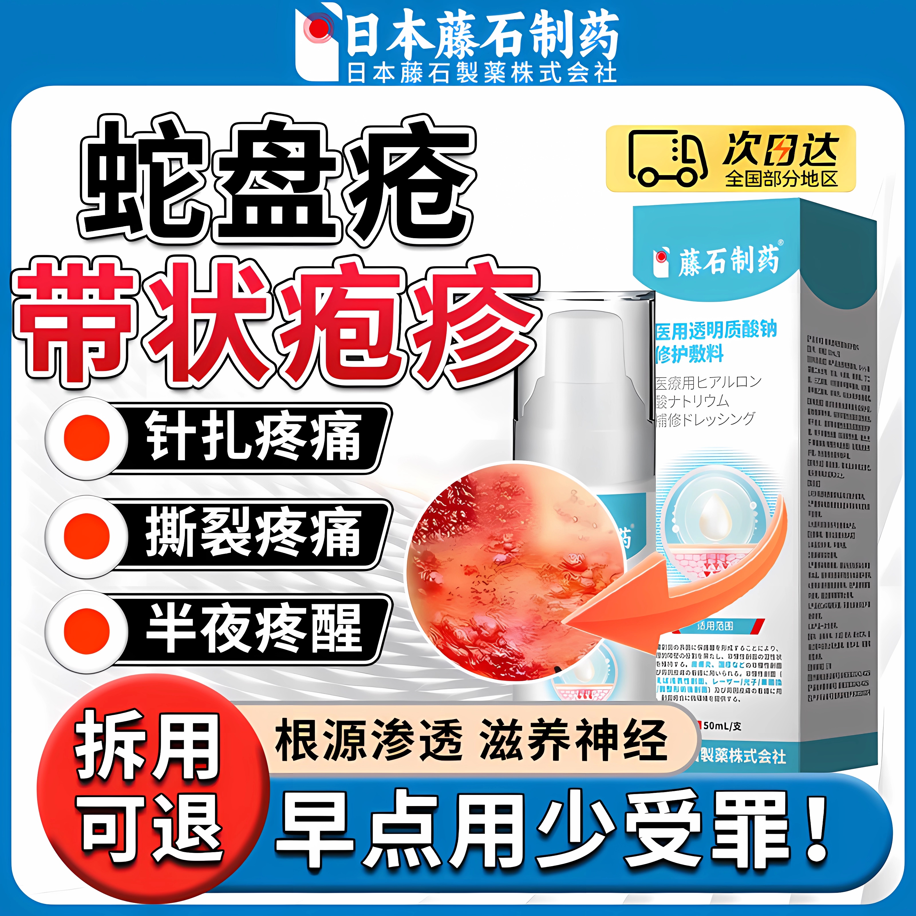 【日本品牌】带状疱疹后遗神经痛