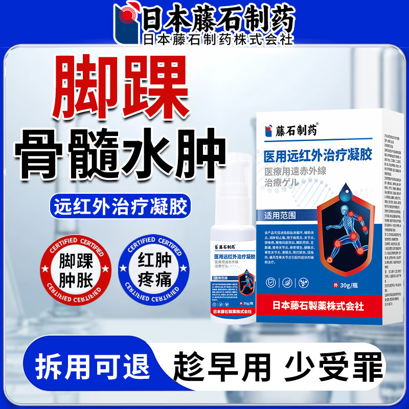 脚踝骨髓水肿专用凝胶脚腕积液崴脚疼痛肿胀滑膜炎关节炎扭损伤JV