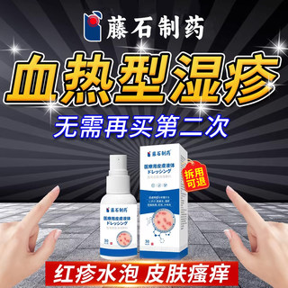 药监认证血热型湿疹瘙痒真菌感染可搭药膏止痒去外用顽固皮炎根BD