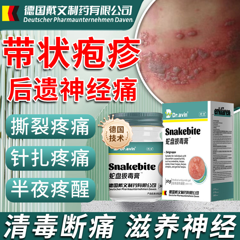 带状疱疹后遗症神经痛特缓解效蛇缠腰治疗带状疱疹的外用膏药bd