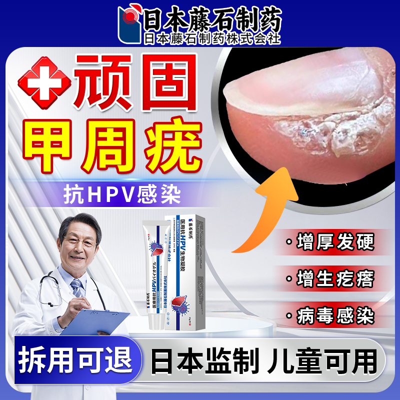 【拆用可退】甲周疣专用膏