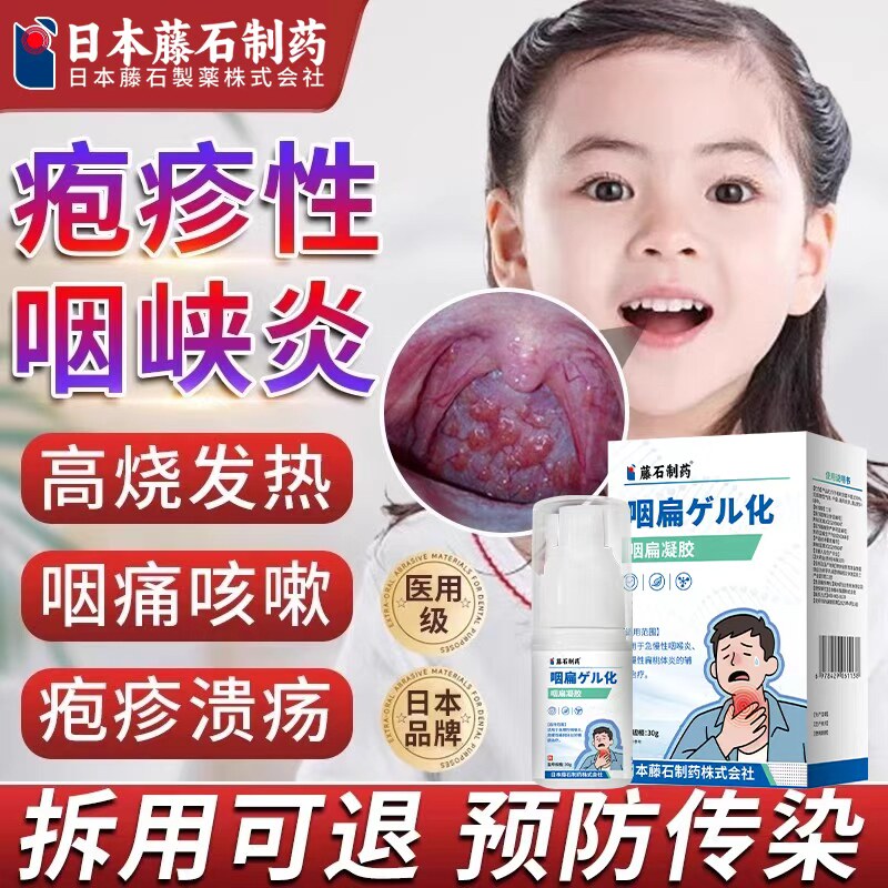 医用疱疹性咽峡炎儿童喷雾嘴里长疱疹发热高烧喉咙痛呕吐可搭药BD