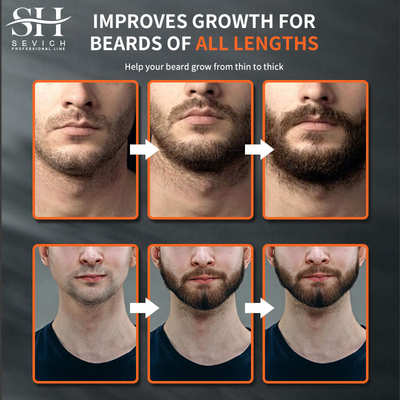 极速chebe Fast Beard Growth Oil Products LHair Loss Treatmen