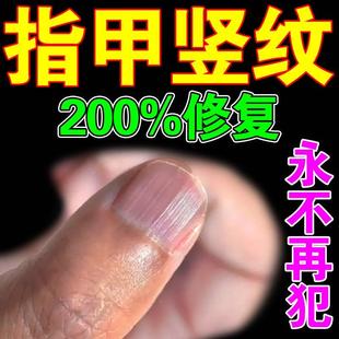 极速指甲竖条纹修复开裂分层断层甲肉H分离凹凸不平受损再生神器