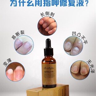 极速受损指甲空甲分离修复甲肉剥离生G长液竖条纹薄软再生营养油