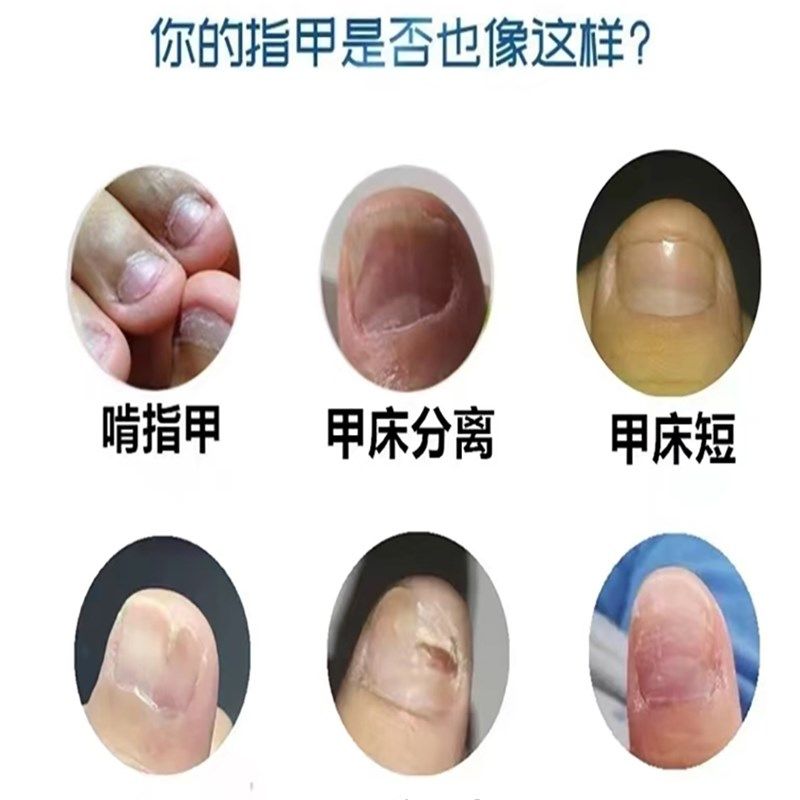 极速指甲快速生长液n儿童咬甲啃甲受损护理液蛋白油促进营养水增,彩妆/香水/美妆工具,指甲油,淘宝优惠券,粉丝福利购,淘宝优惠卷