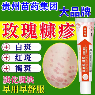 玫瑰糠疹专用膏皮肤红斑疹过敏止痒膏花斑藓真菌感染儿童喷雾