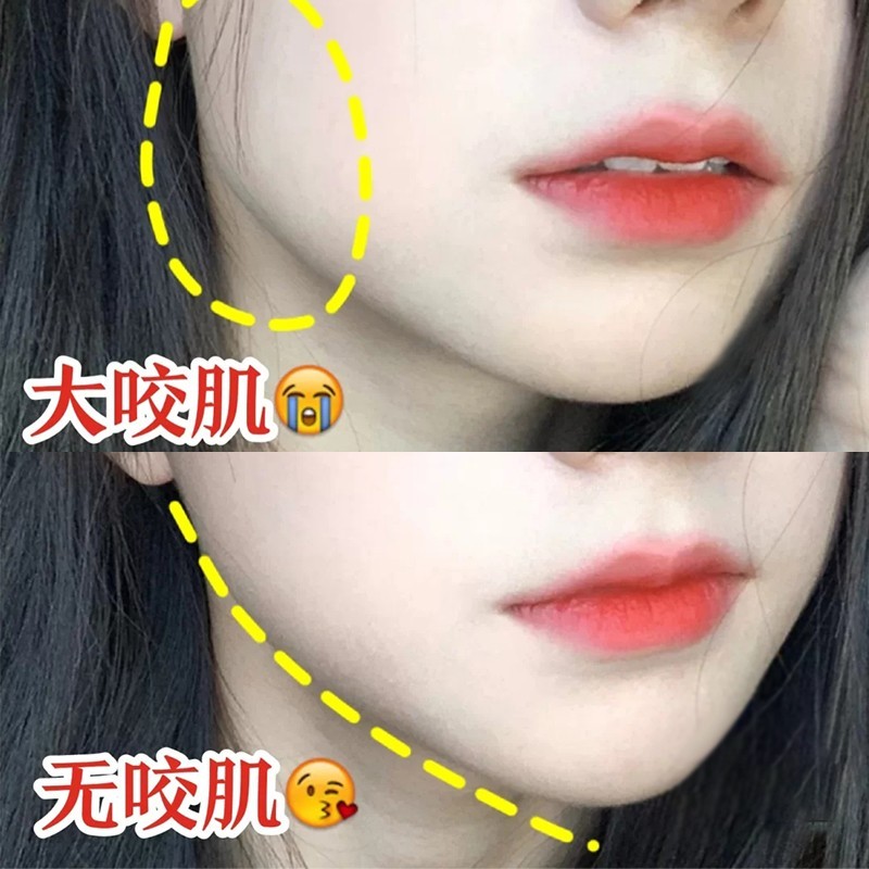 【小红书推荐】大脸克星 小脸神器 脸大不求人 秒变瓜子脸 买5送5