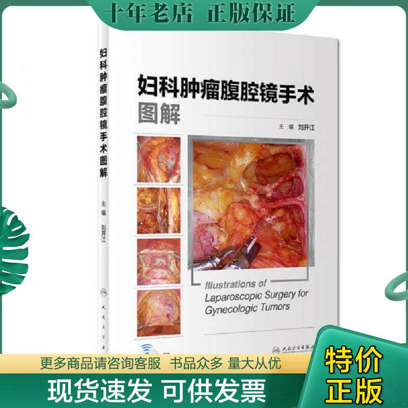正版现货9787117271066 妇科肿瘤腹腔镜手术图解 刘开江 人民卫生出版社