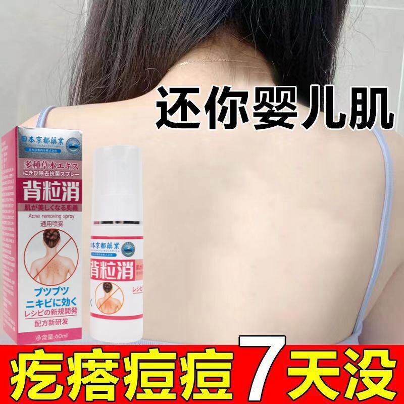正品背粒消背部前胸除螨背后长痘后背痘痘喷雾清爽祛痘印