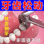 极速 牙齿松动牙龈委缩牙齿晃动P出血牙齿肿痛修复固 101%固定