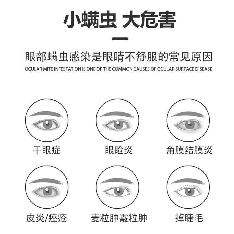 极速眼睛痒除螨滴眼液干涩发痒红血丝眼部清洁Q修正视疲劳非湿巾,ZIPPO/瑞士军刀/眼镜,滴眼液、护眼用品,淘宝优惠券,粉丝福利购,淘宝优惠卷