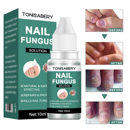 好货10ml Fungal Nail Repair Essence Serum Care Treatment Foo
