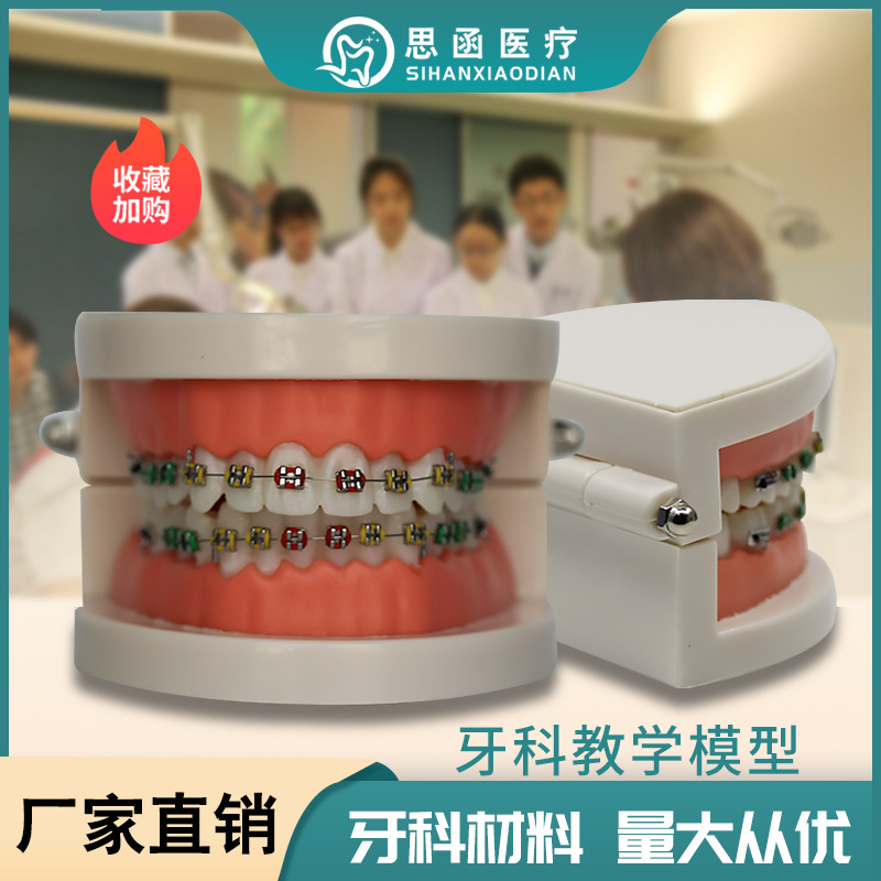 牙科材料 教学矫正模型 1倍大金属托槽模型 口腔齿科器材口腔
