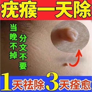 去除腋下肉粒刺脖子丝状忧克尤膏