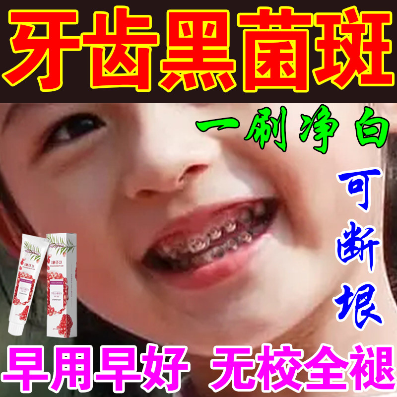 儿童去牙菌斑黑牙齿黑斑去除牙菌斑祛黄洗白蛀牙祛除神器美白牙膏