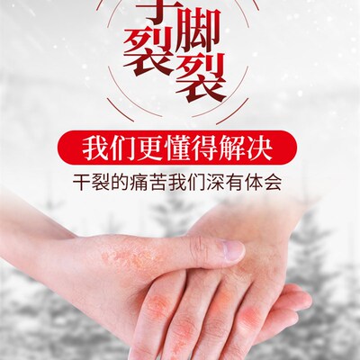 迪王愈裂宝蜂蜡抑菌修护膏冻裂膏手脚后跟防开裂口脸上耳朵冻消膏