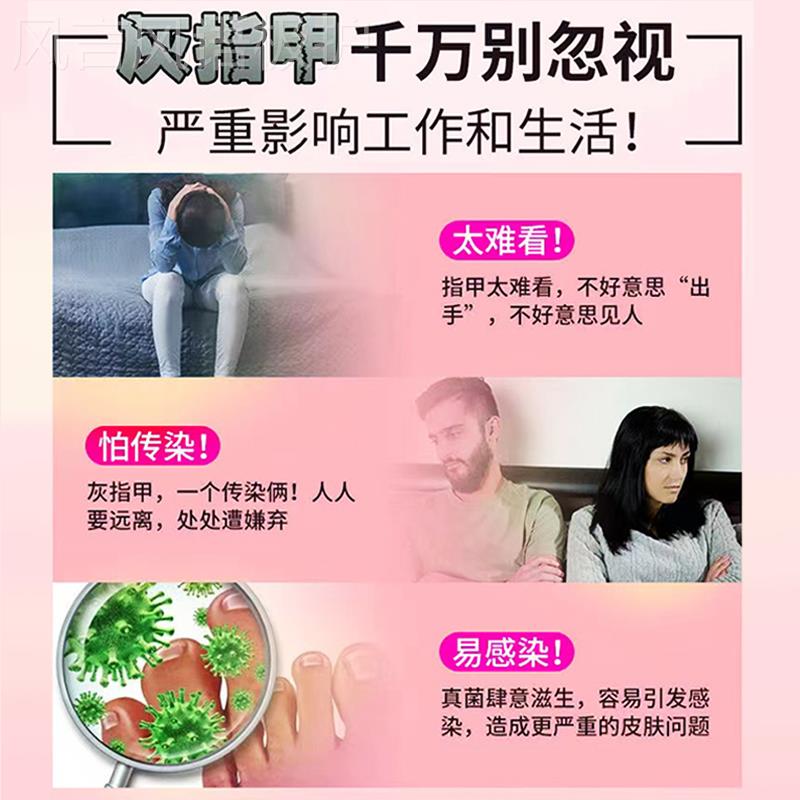 极速脚指甲发黄变厚变硬灰指甲脚趾甲黄黑空坏甲修复甲层分离亮甲