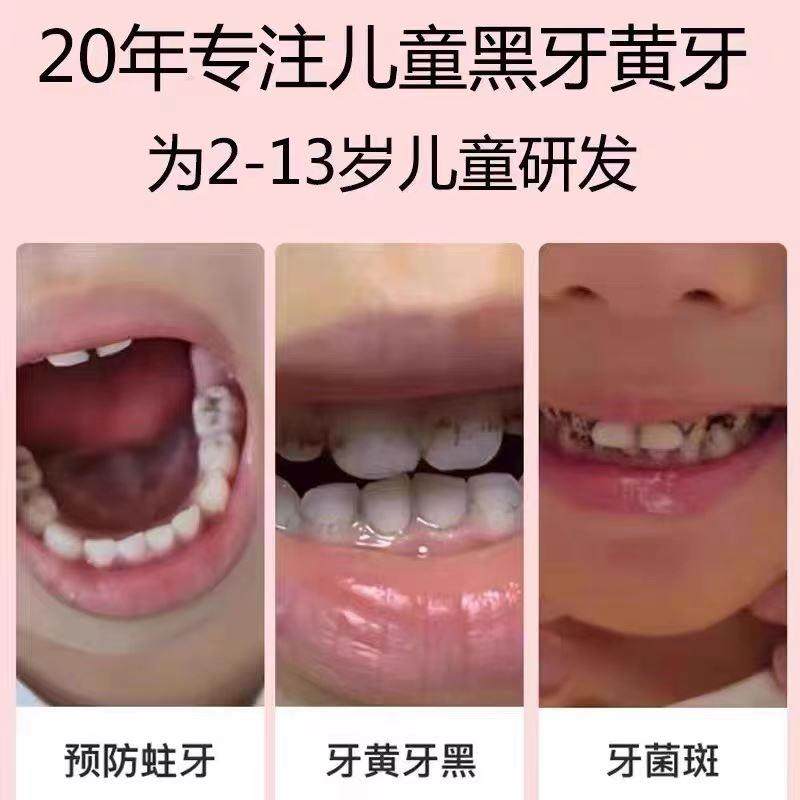 儿童牙膏含氟防蛀牙3一6一12岁换牙龋齿修复去黑斑牙菌斑非可吞咽