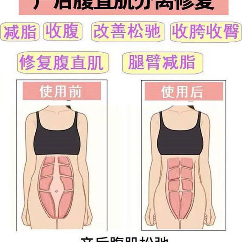 极速腹直肌分离修复贴产后肚皮紧致盆底肌非修复仪神器分离收腹专