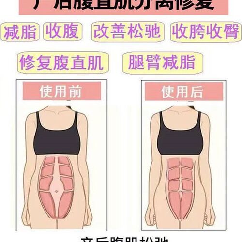 极速腹直肌分离修复贴产后肚皮紧致盆底肌非修复仪神器分离收腹专