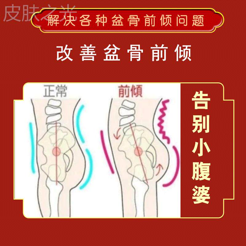 极速骨盆前倾矫正器治假胯宽收缩骨盆矫正胯骨尾巴骨疼小腹凸起神