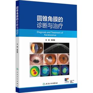 圆锥角膜 诊断与治疗