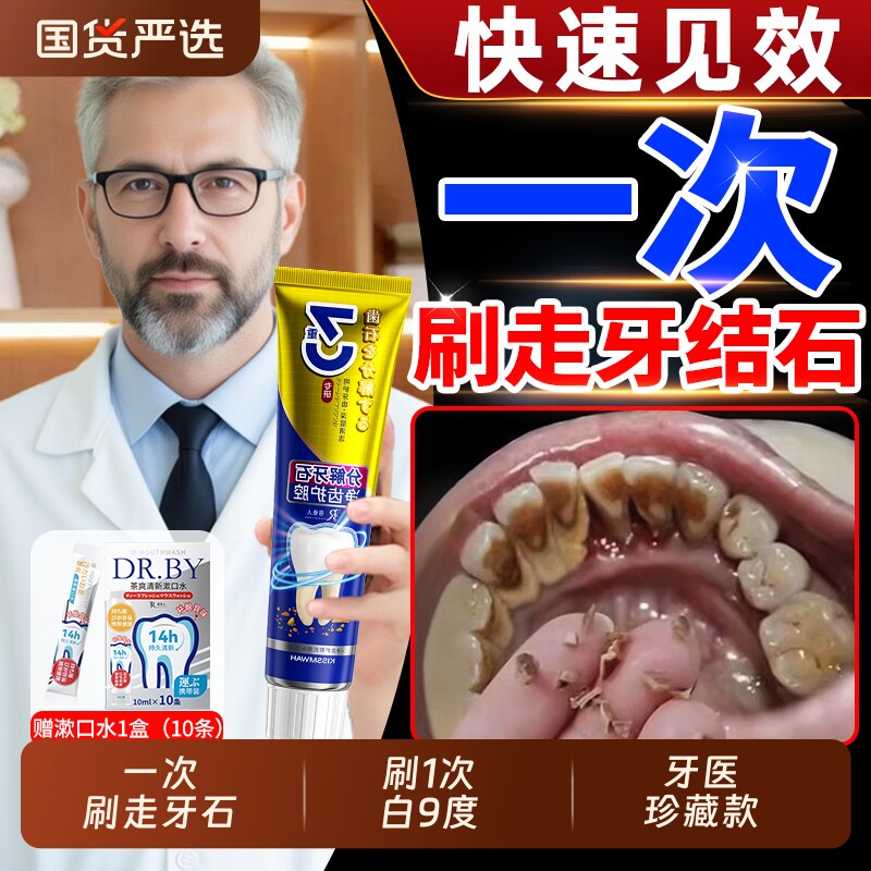 牙膏速效去黄去口臭美白烟渍溶解牙垢神器专用去除牙结石牙石牙齿