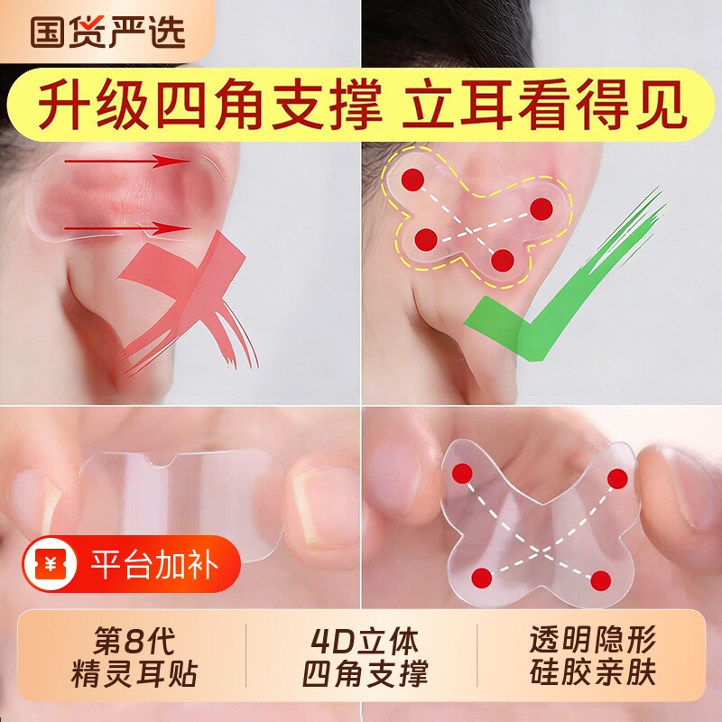 蝴蝶精灵耳贴强支撑隐形不痛女生固定招风耳矫正器立耳定型神器