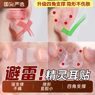 蝴蝶精灵耳贴强支撑女生隐形显脸小固定招风耳矫正器立耳定型神器