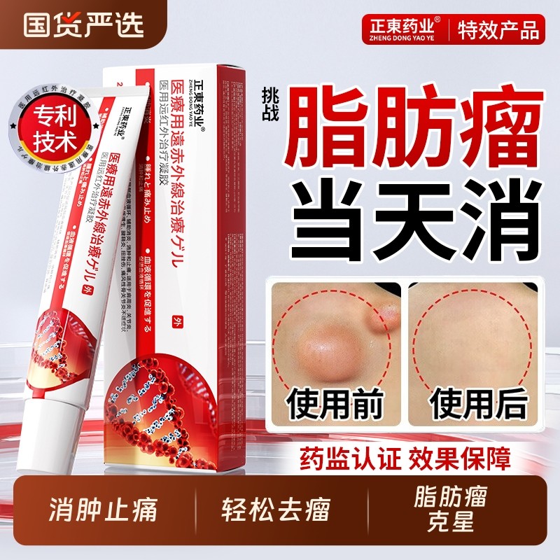 远红外治疗凝胶脂肪瘤包消除膏去除神器纤维皮脂腺囊肿硬肿块结节,医疗器械,膏药贴（器械）,淘宝优惠券,粉丝福利购,淘宝优惠卷