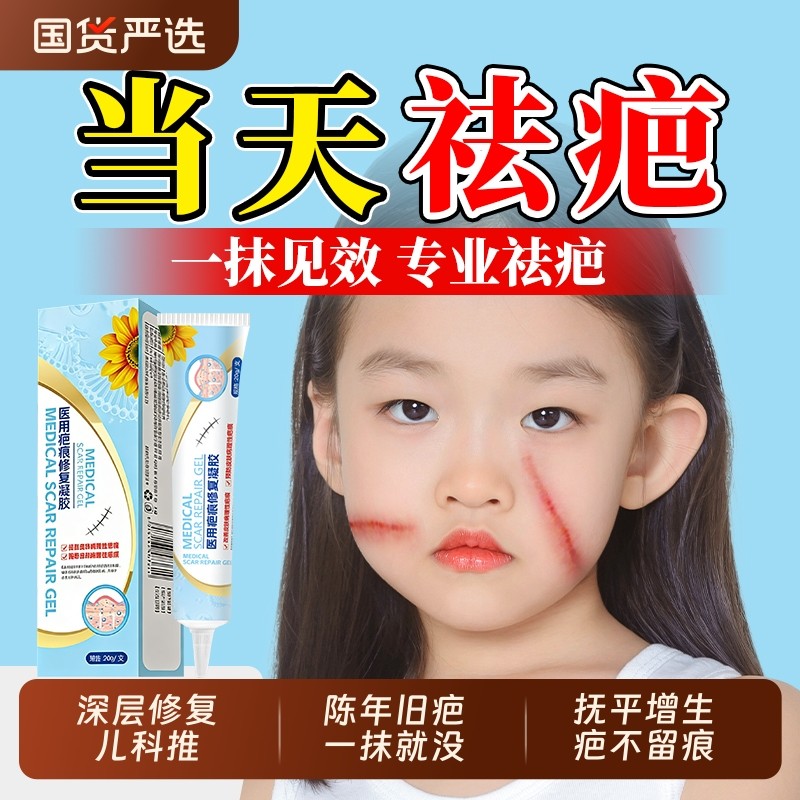 祛疤膏儿童专用小孩去除疤痕增生凸起修复摔烫伤医用硅酮凝胶生长
