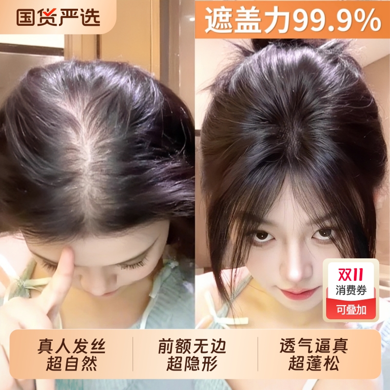 自然隐形前额补发片|146人收藏