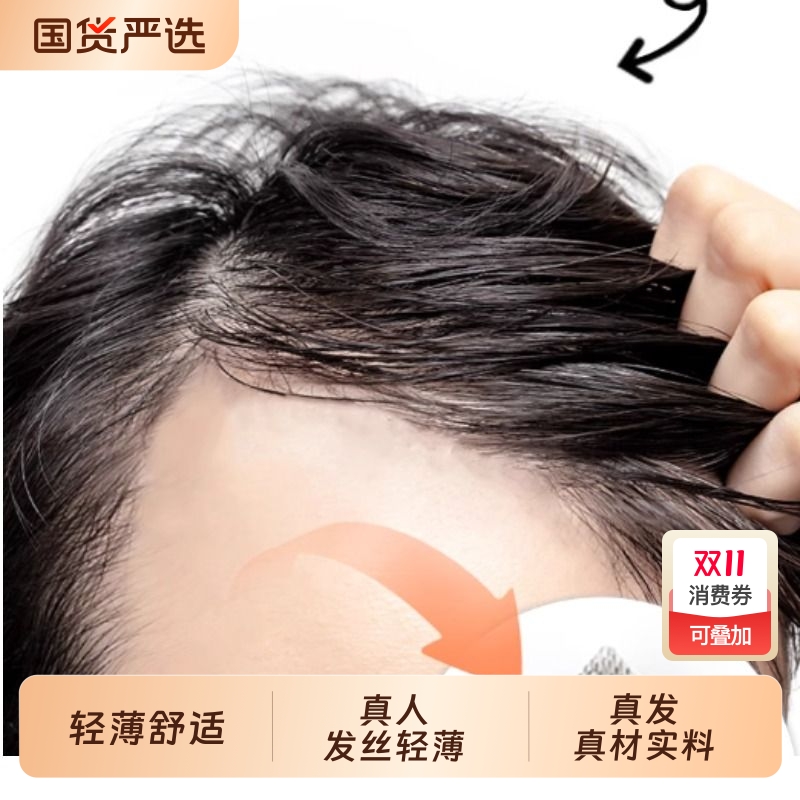男士发际线贴遮盖秃斑脱发秃顶