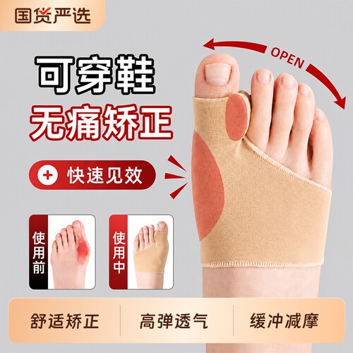 拇指外翻矫正绑带款神器