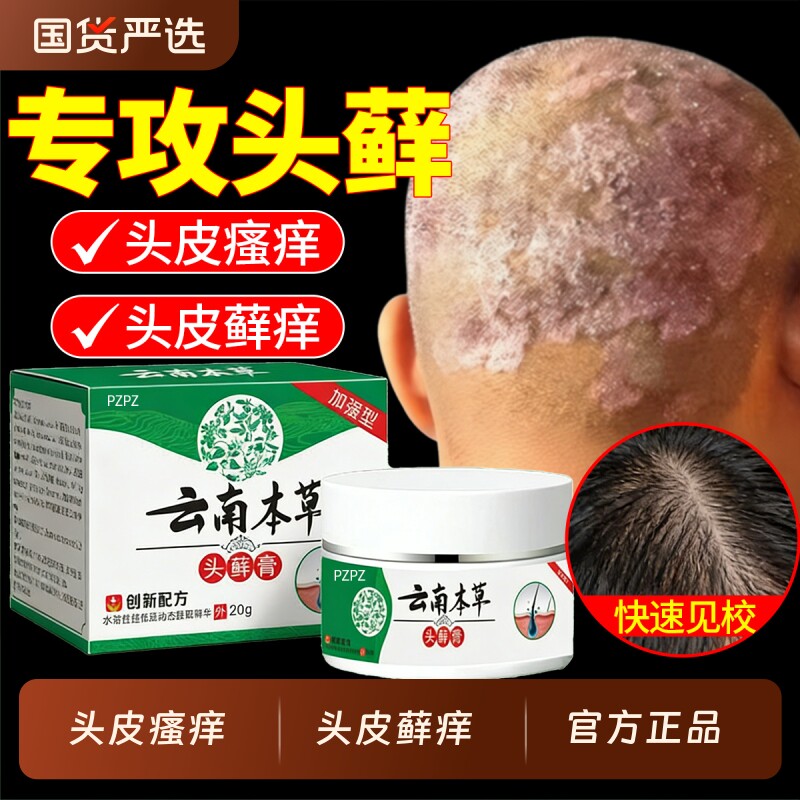 云南本草头癣膏头皮屑瘙痒银屑毛囊脂溢性皮炎真菌感染头癣正品炎