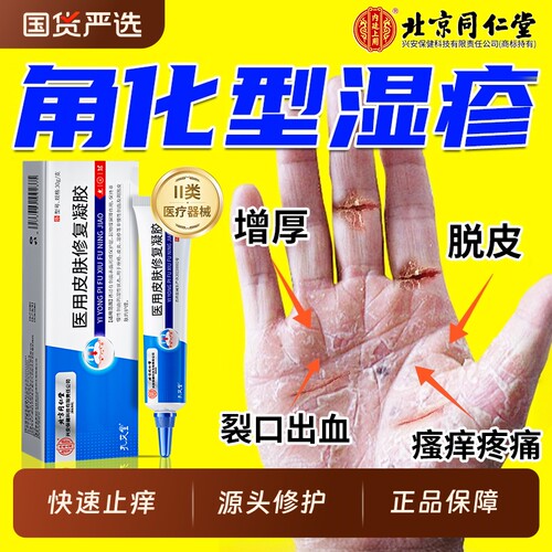 北京同仁堂医用角化型湿疹凝胶