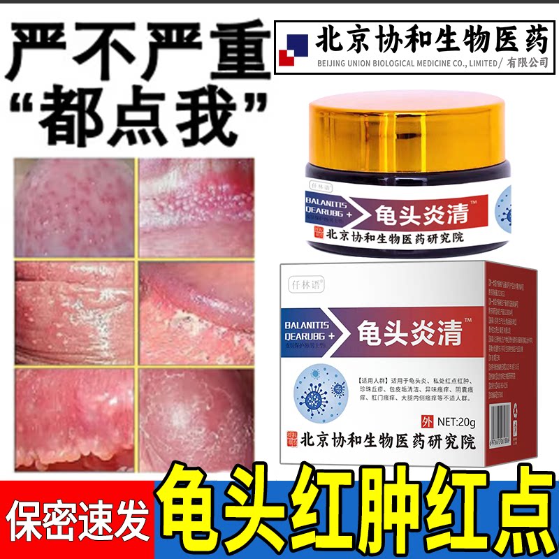 龟头上有小红点斑红肿裂口脱皮炎症瘙痒真菌感染霉菌性白垢包皮xq