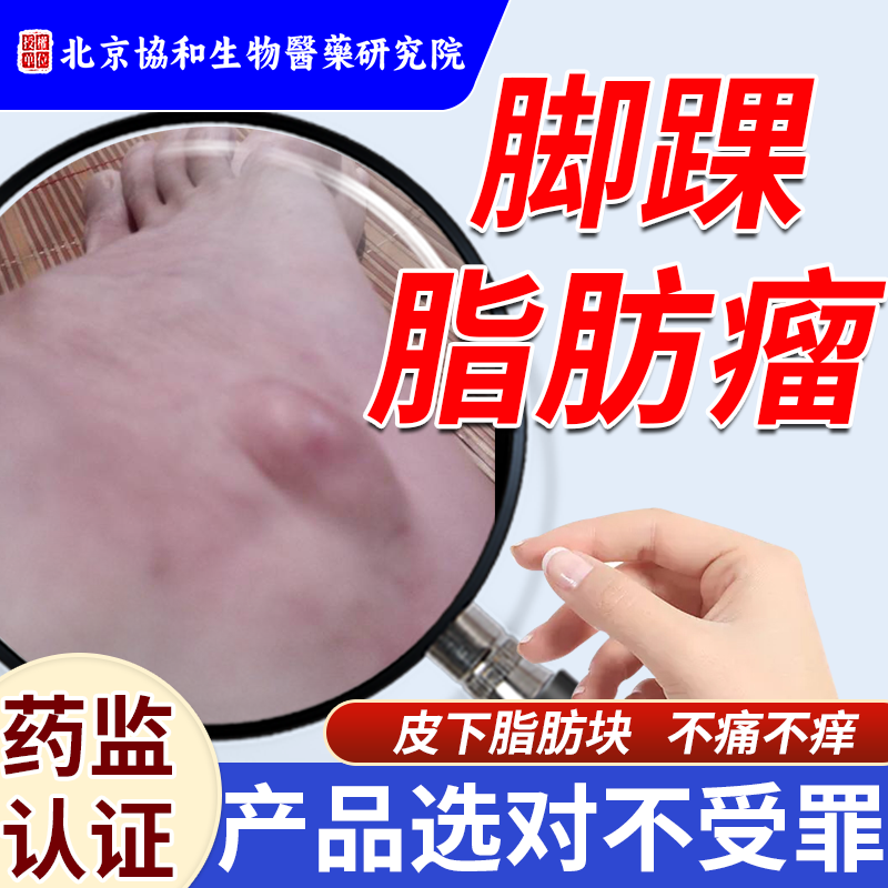 脚踝脂肪瘤结节肿硬块去皮下粉瘤皮肤纤维瘤除可搭配消瘤药膏贴rj