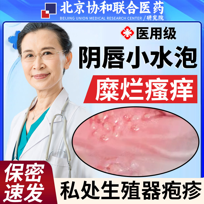 女性阴唇外阴小水泡单纯生殖器疱疹剂药房同售搭配治疗仪喷雾xq
