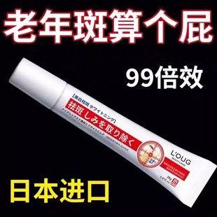 去斑霜专治祛老年斑专用脸部去手上手部强力去除 一抹无斑