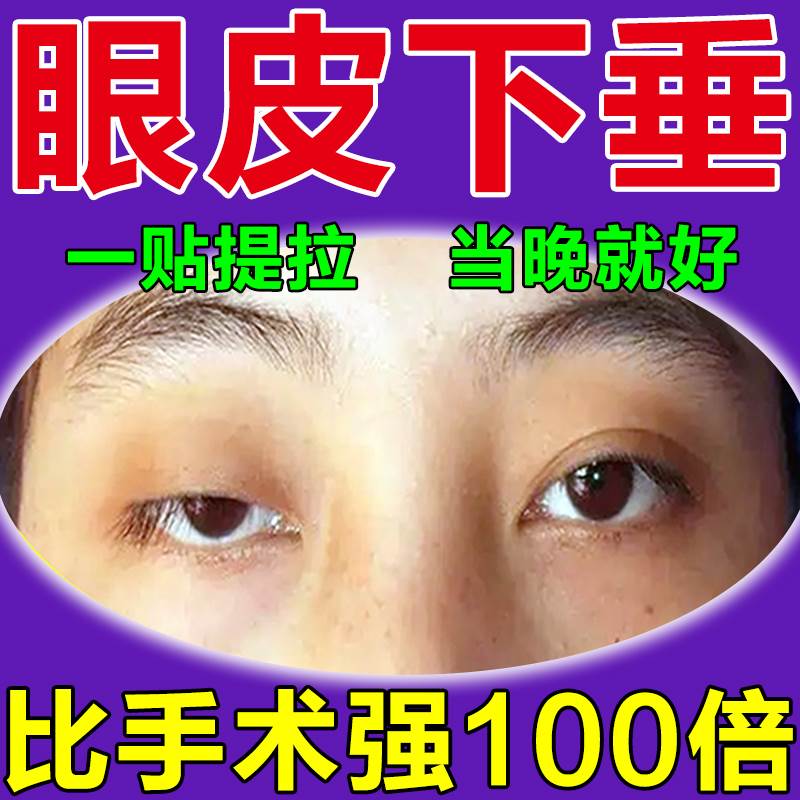好货上眼皮下垂提拉贴防眼脸下垂松弛去肿眼泡脂肪紧致双眼皮专用